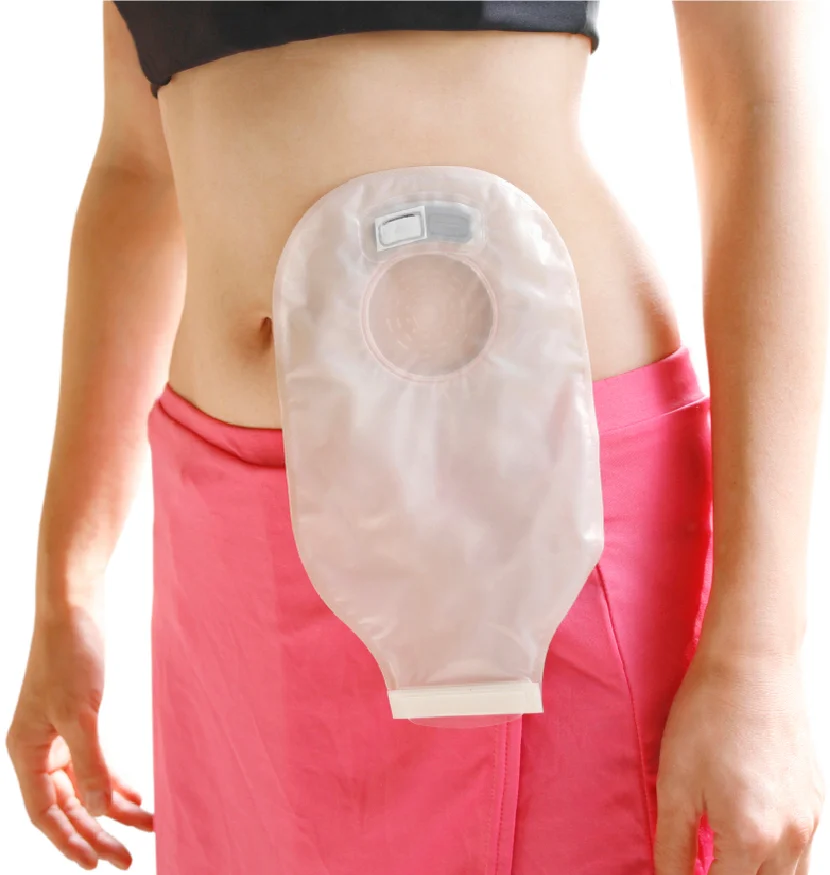 Stoma Clinic